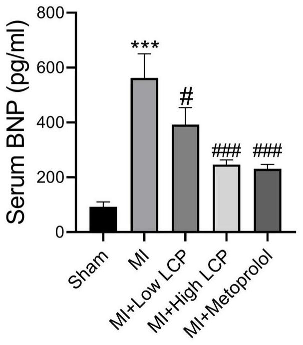 Application of lactucopicrin in preparation of medicine for preventing and treating heart failure and pathological cardiac remodeling