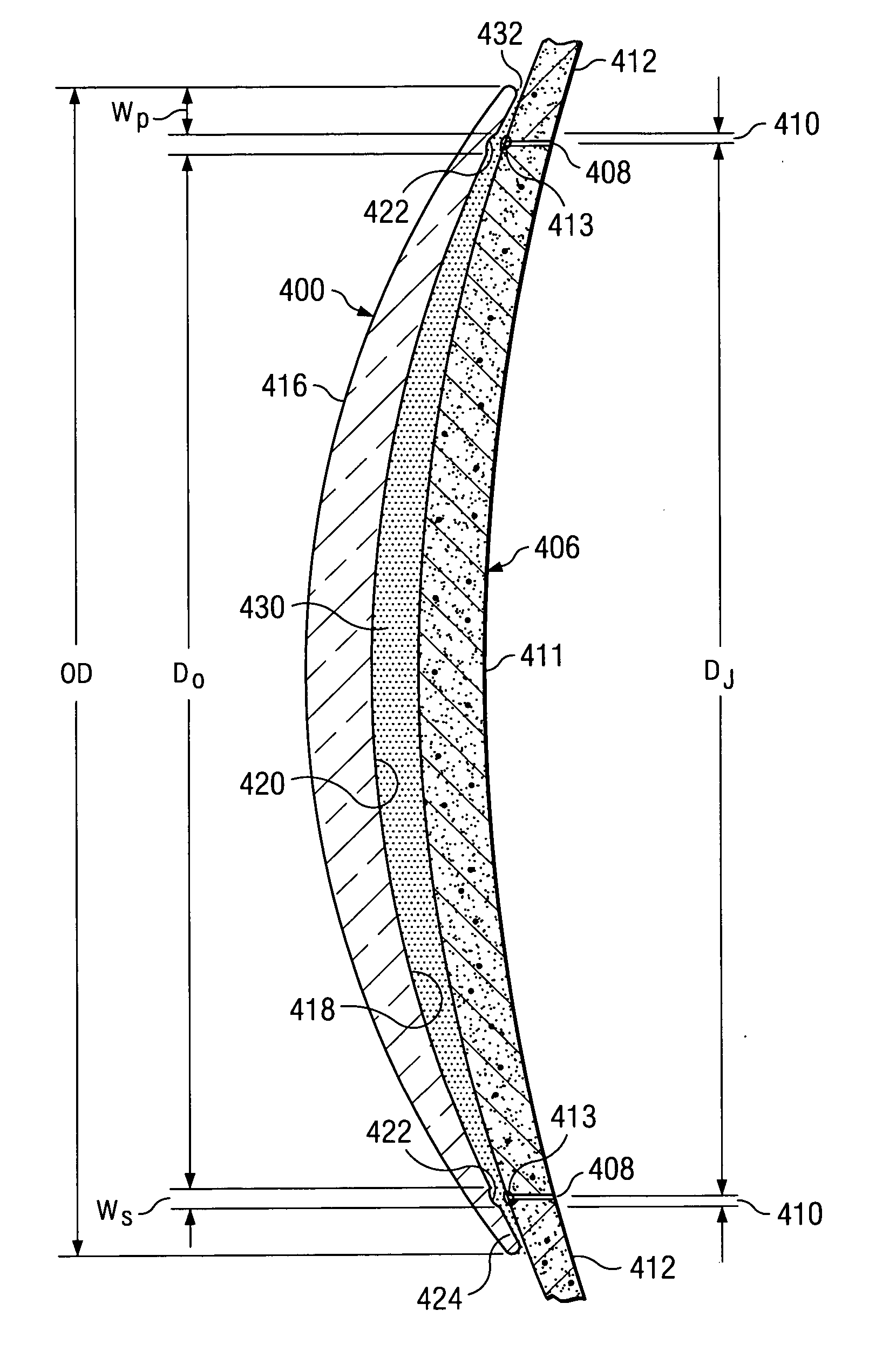 Rigid gas permeable contact lens with 3-part curvature