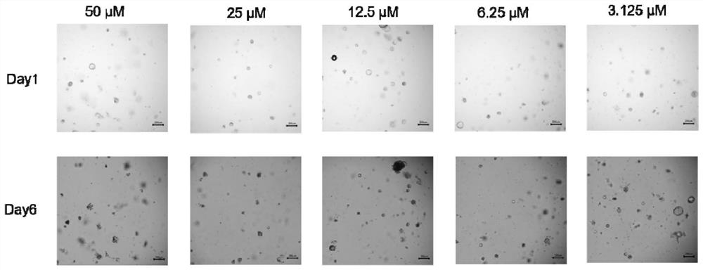 Culture method for screening tumor organoids based on P53 mutation