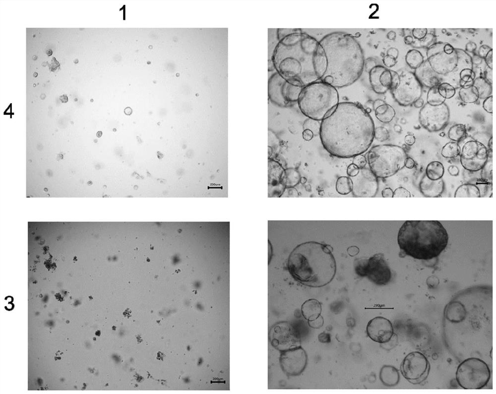 Culture method for screening tumor organoids based on P53 mutation