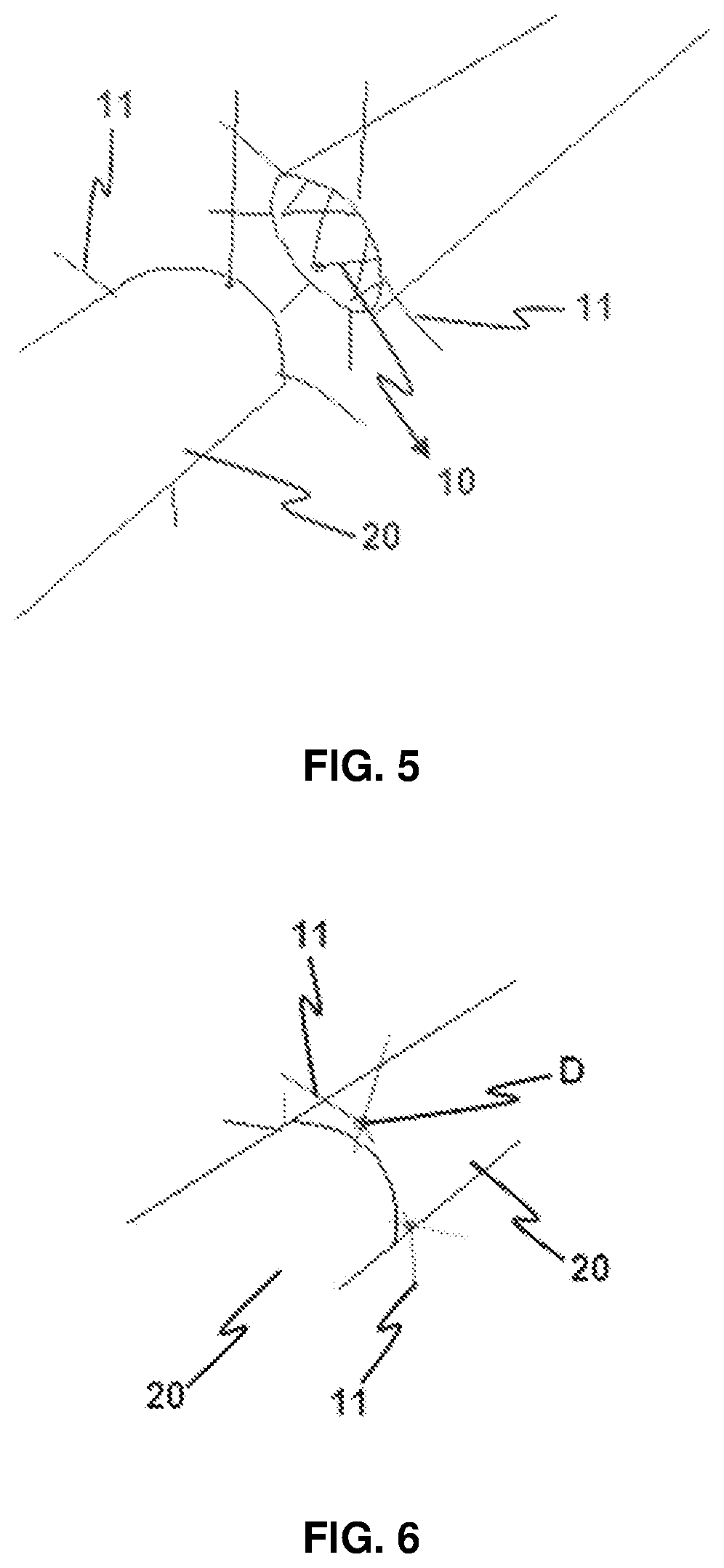 Suture material developed for end-to-end anastomosis