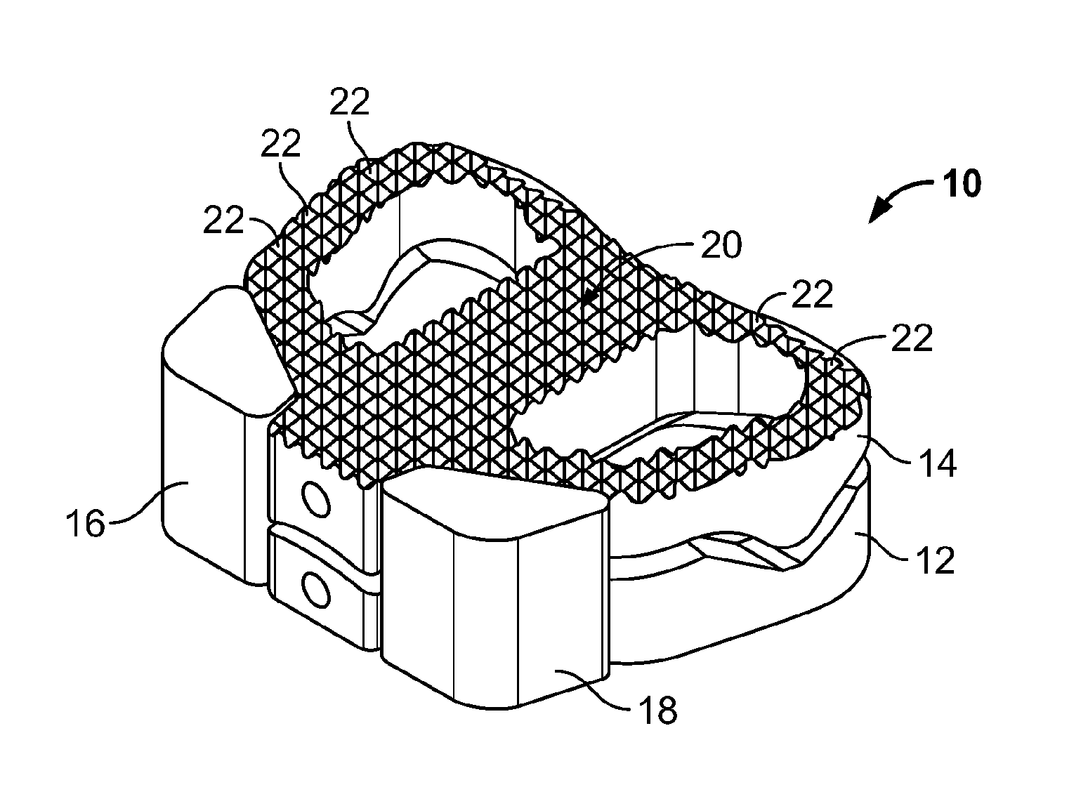 Spinal Implant, Instrument for Preparation and Method of Use