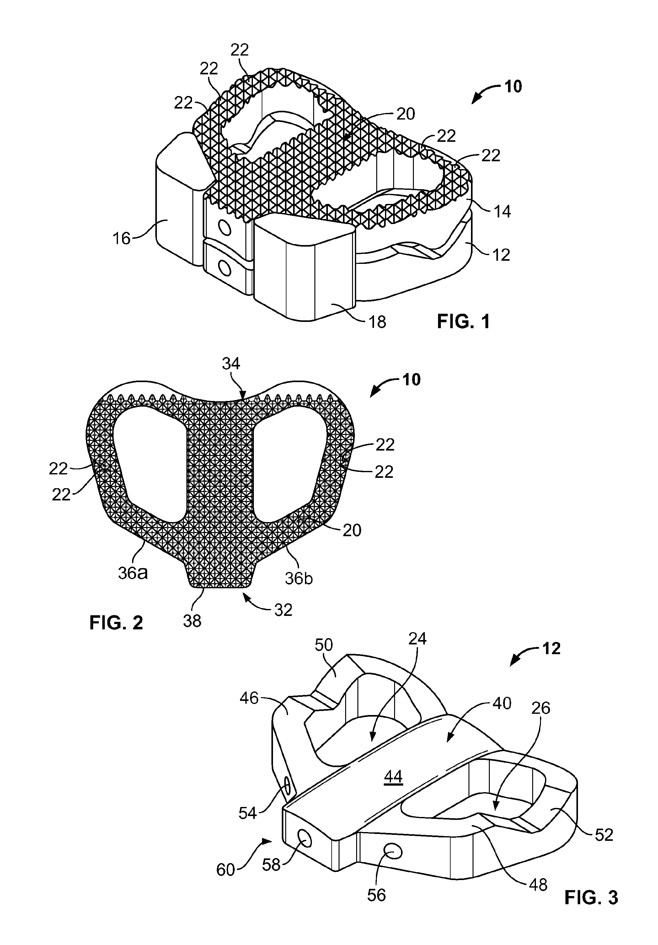 Spinal Implant, Instrument for Preparation and Method of Use