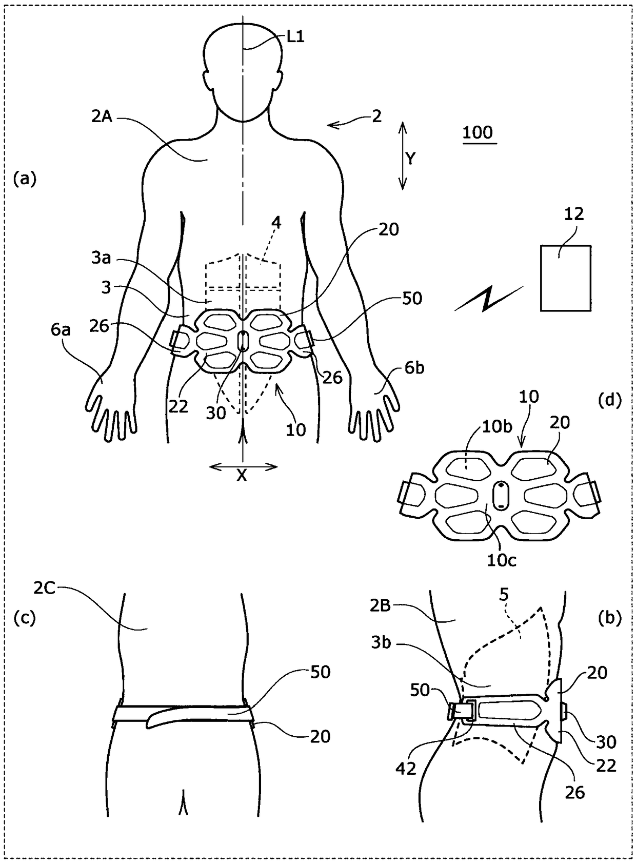 Muscle electrostimulation device