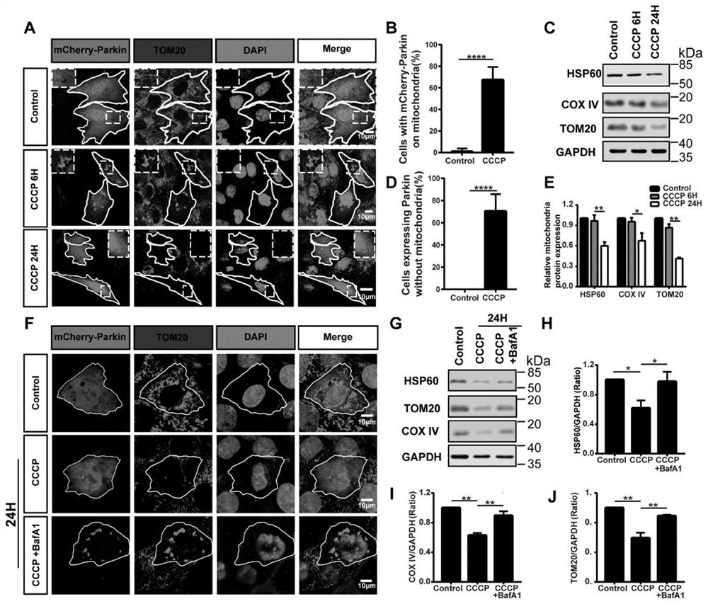 Application of deferiprone in inhibition of ototoxicity of aminoglycoside drugs