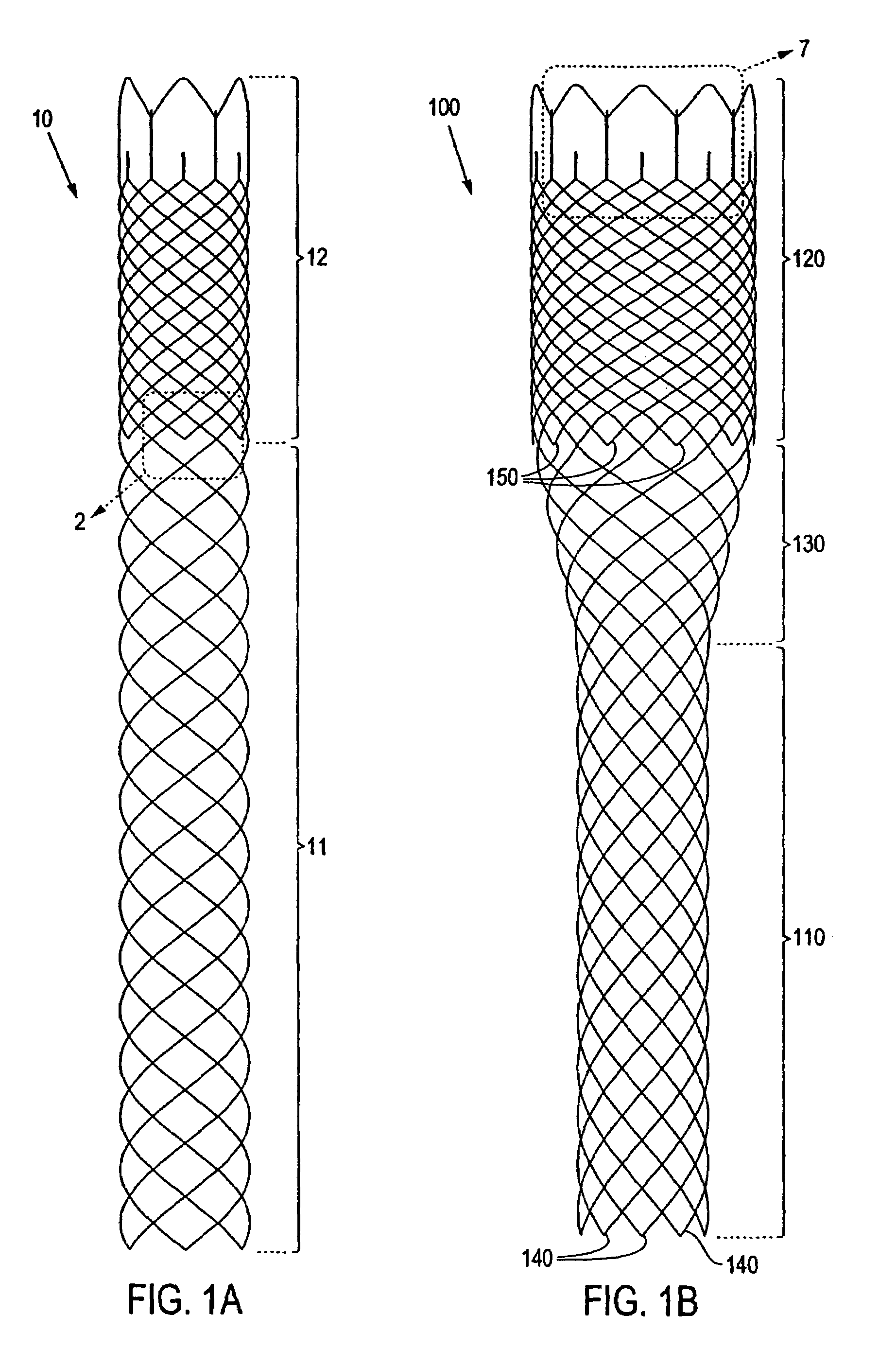 Braided stent method for its manufacture