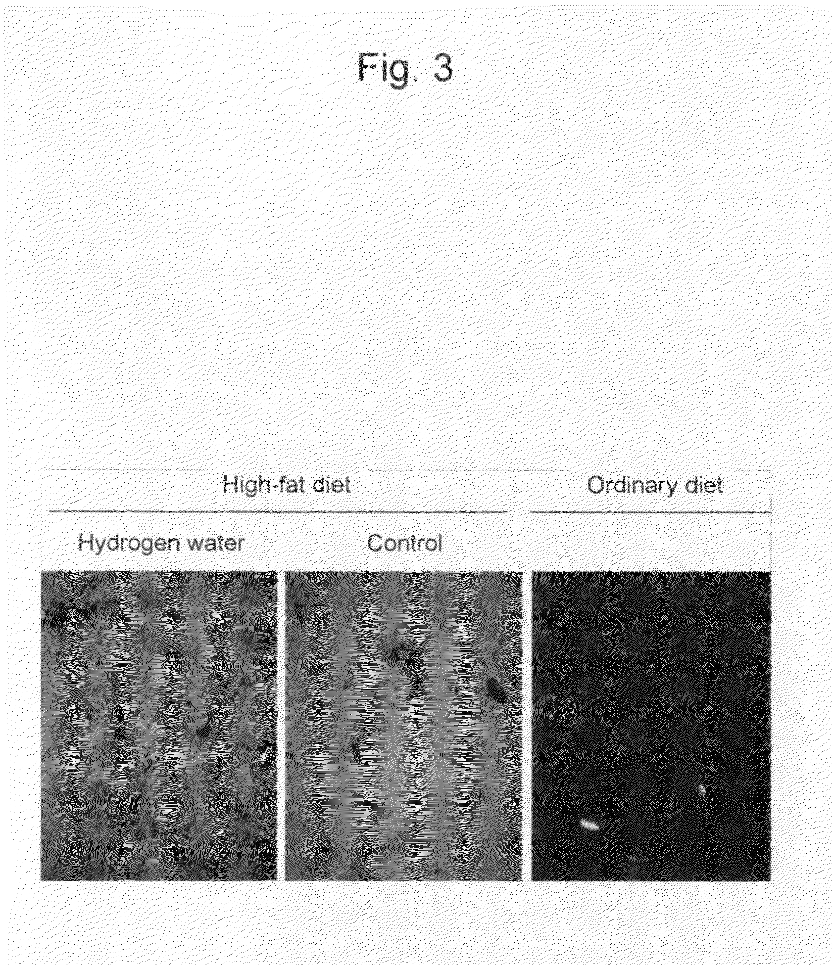 Lipid metabolism improving agent containing hydrogen molecules