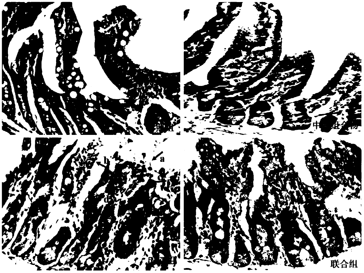 A kind of traditional Chinese medicine composition and its preparation method and application