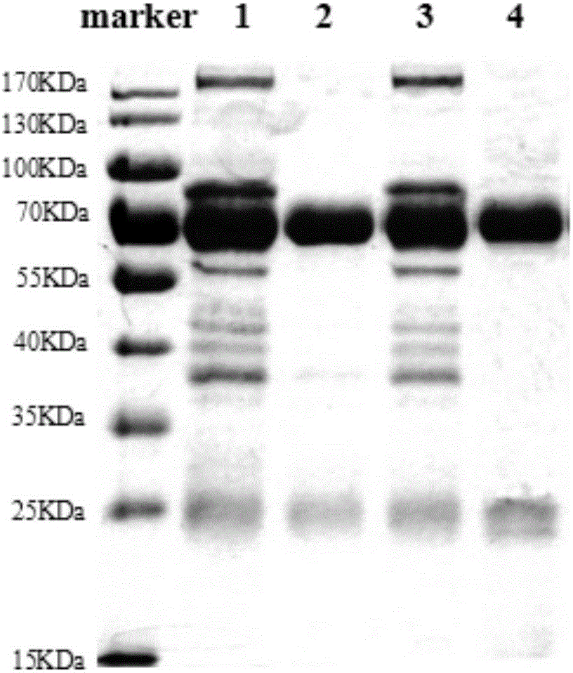 Anti-dermatophyte specific yolk antibody, preparation method and application thereof