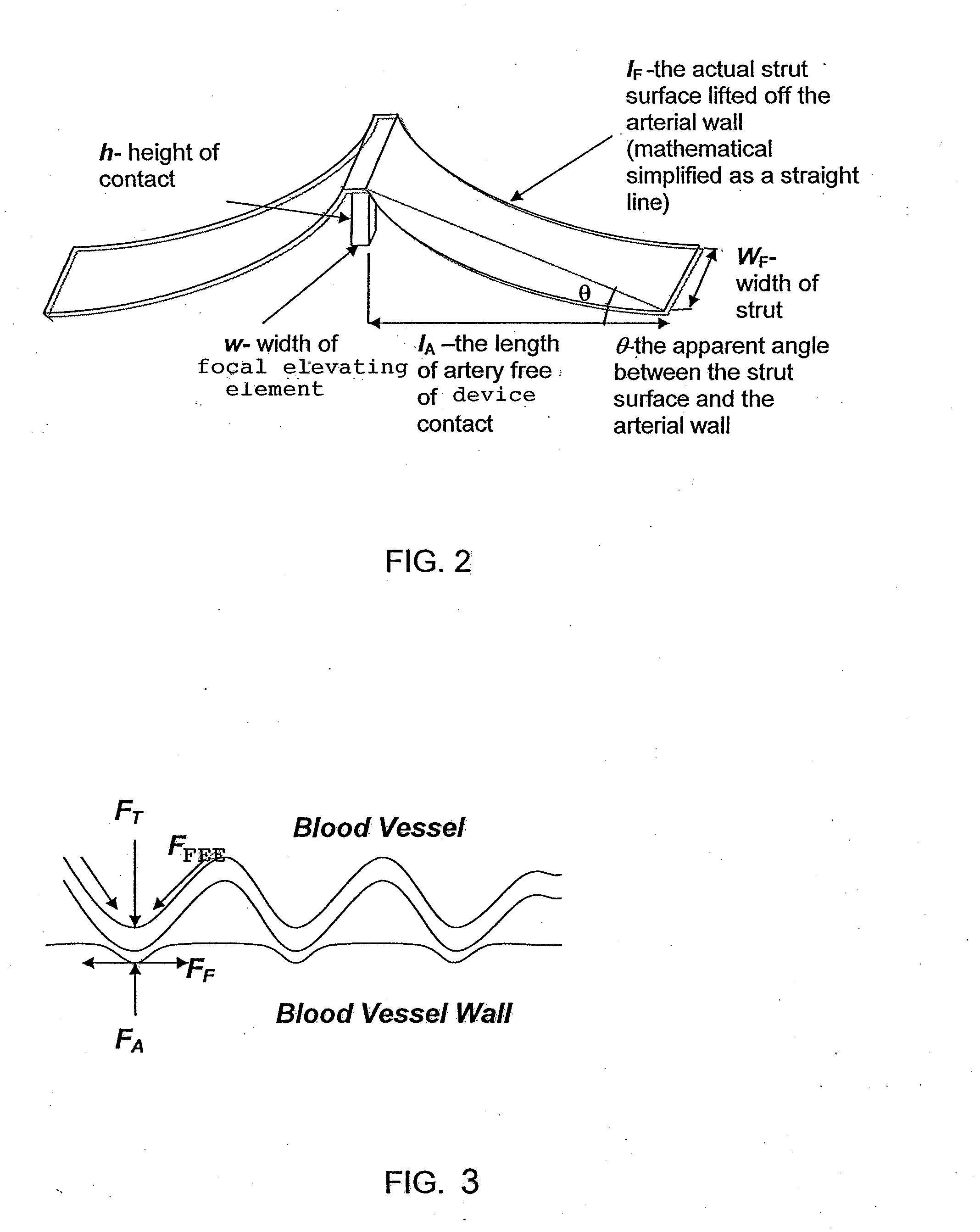 Stent device having focal elevating elements for minimal surface area contact with lumen walls