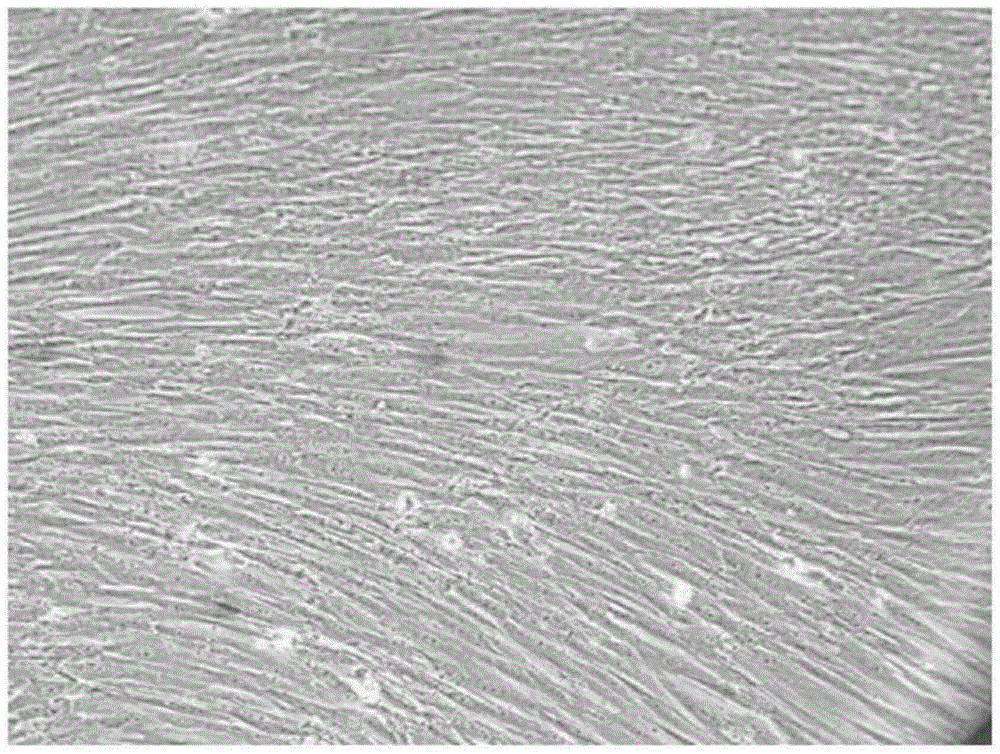 Preparation method for mesenchymal stem cells from placental decidua basalis