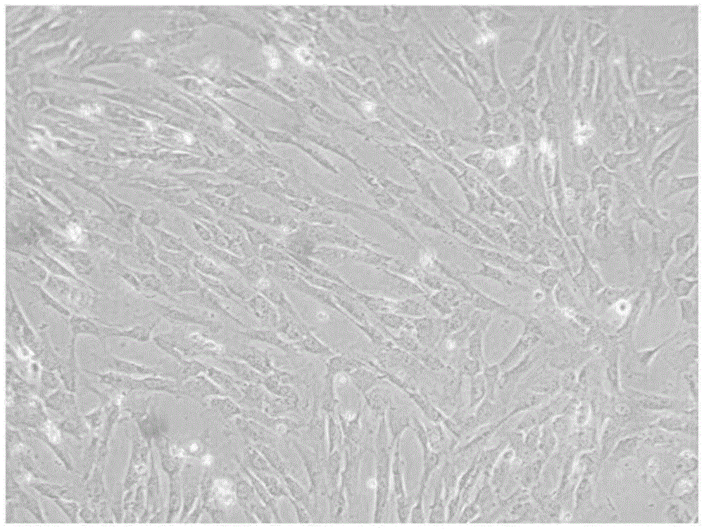 Preparation method for mesenchymal stem cells from placental decidua basalis