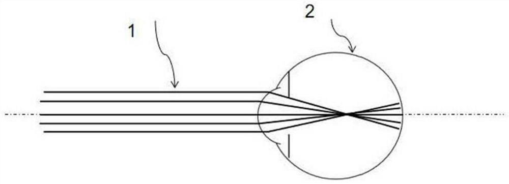 Ophthalmic lenses to prevent and slow the progression of myopia