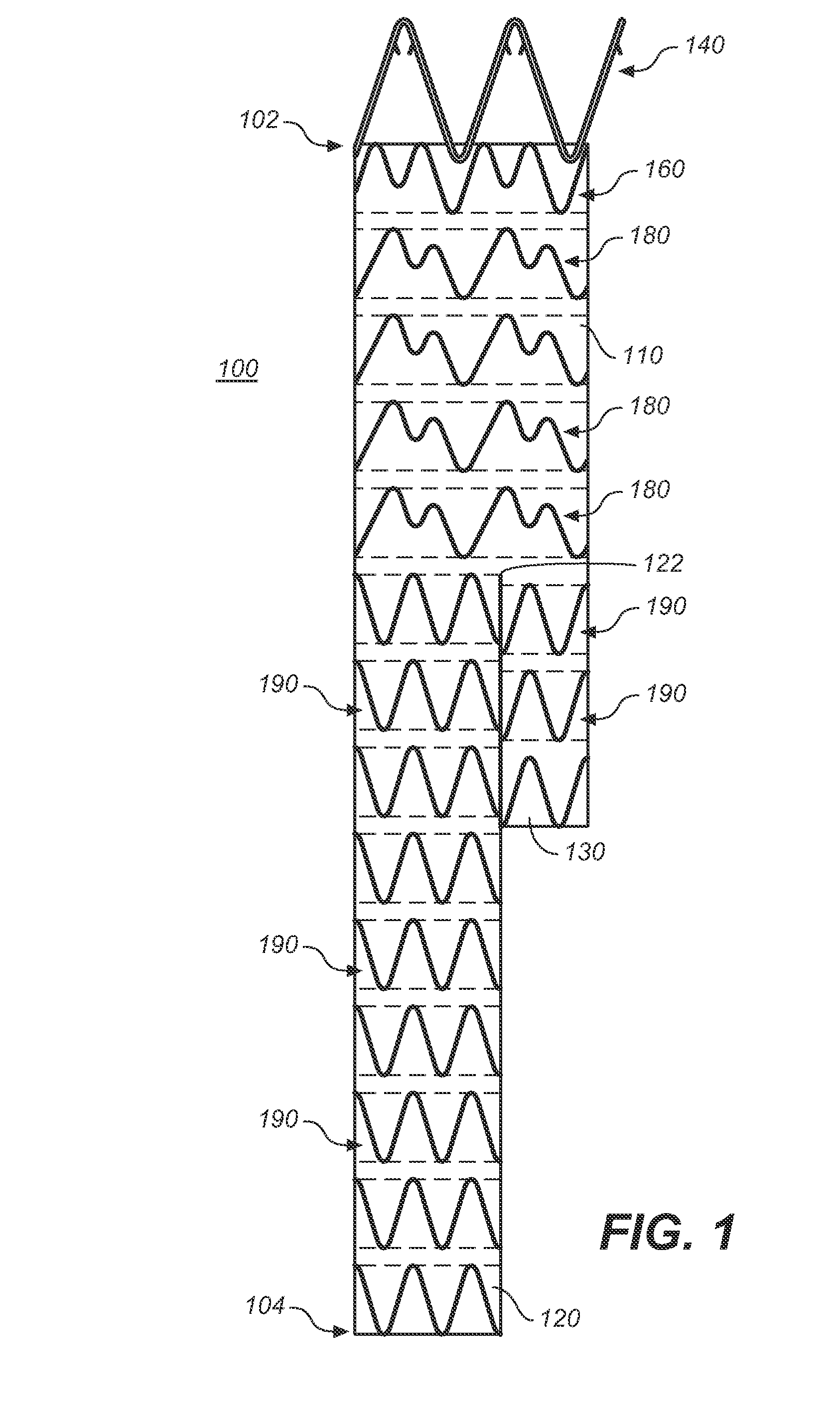 Endoluminal prosthesis