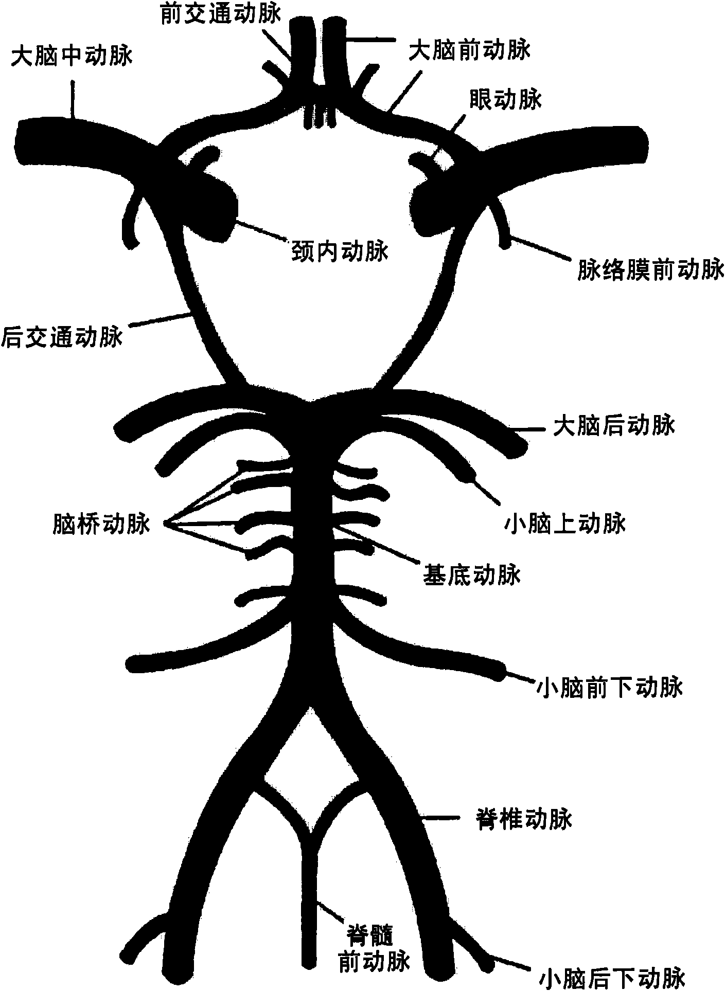 A drug delivery system for the prevention of cerebral vasospasm