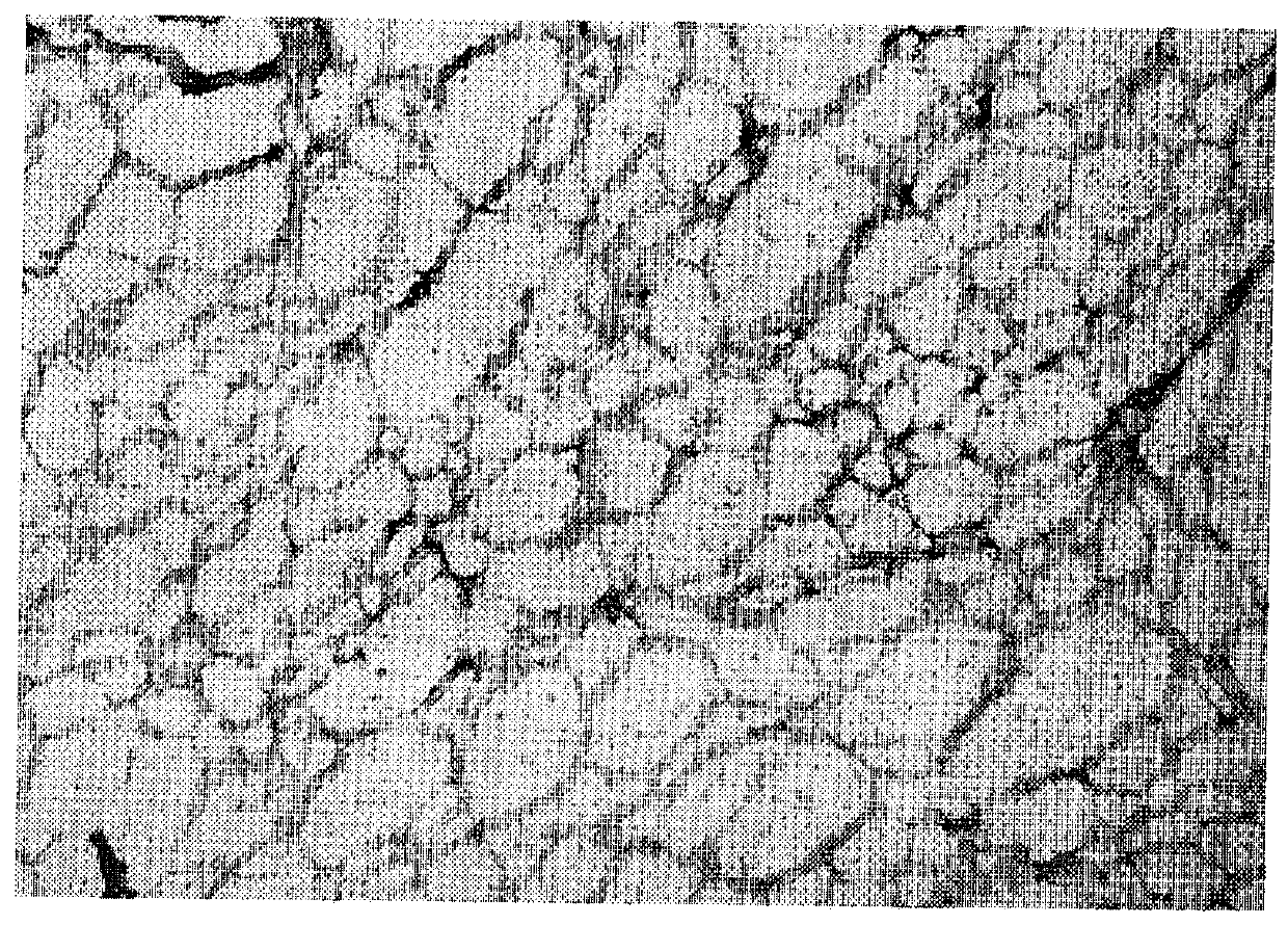 a tissue decellularized fluid