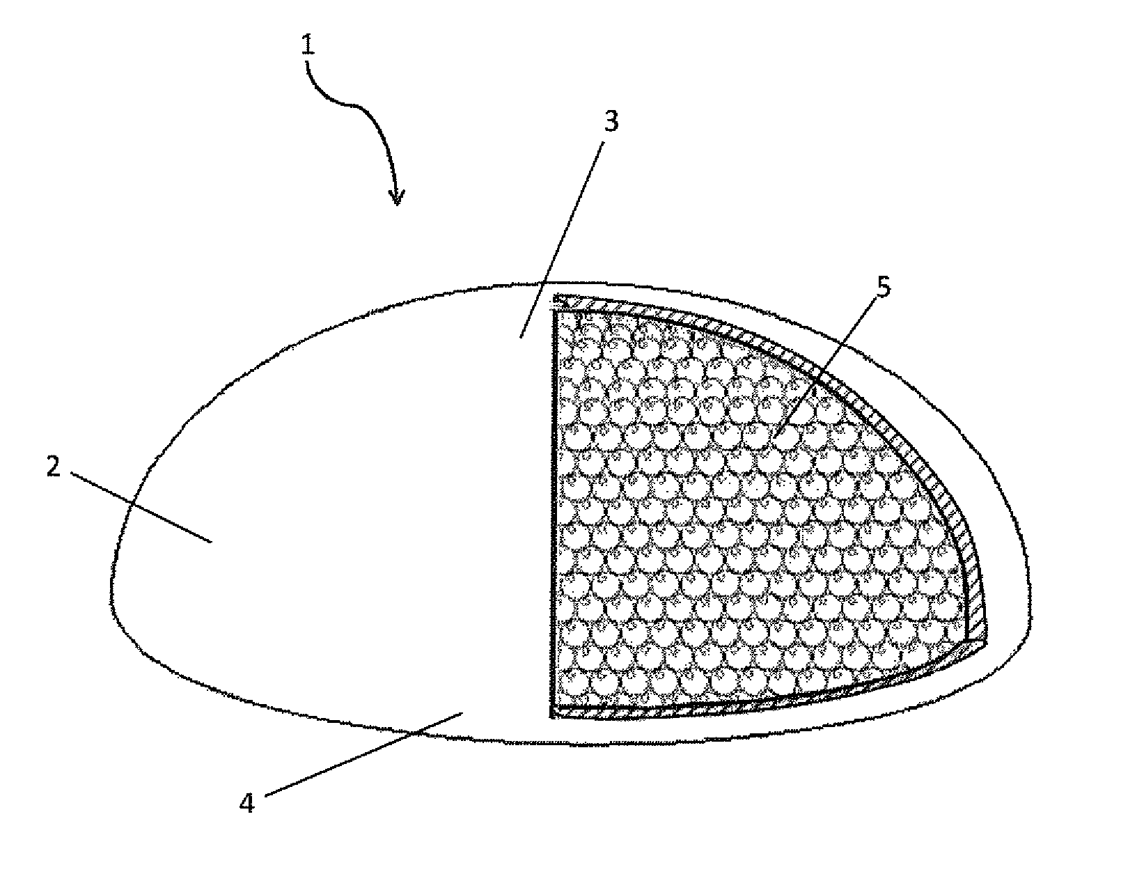 Mammary prosthesis filled with expanded polymer microspheres