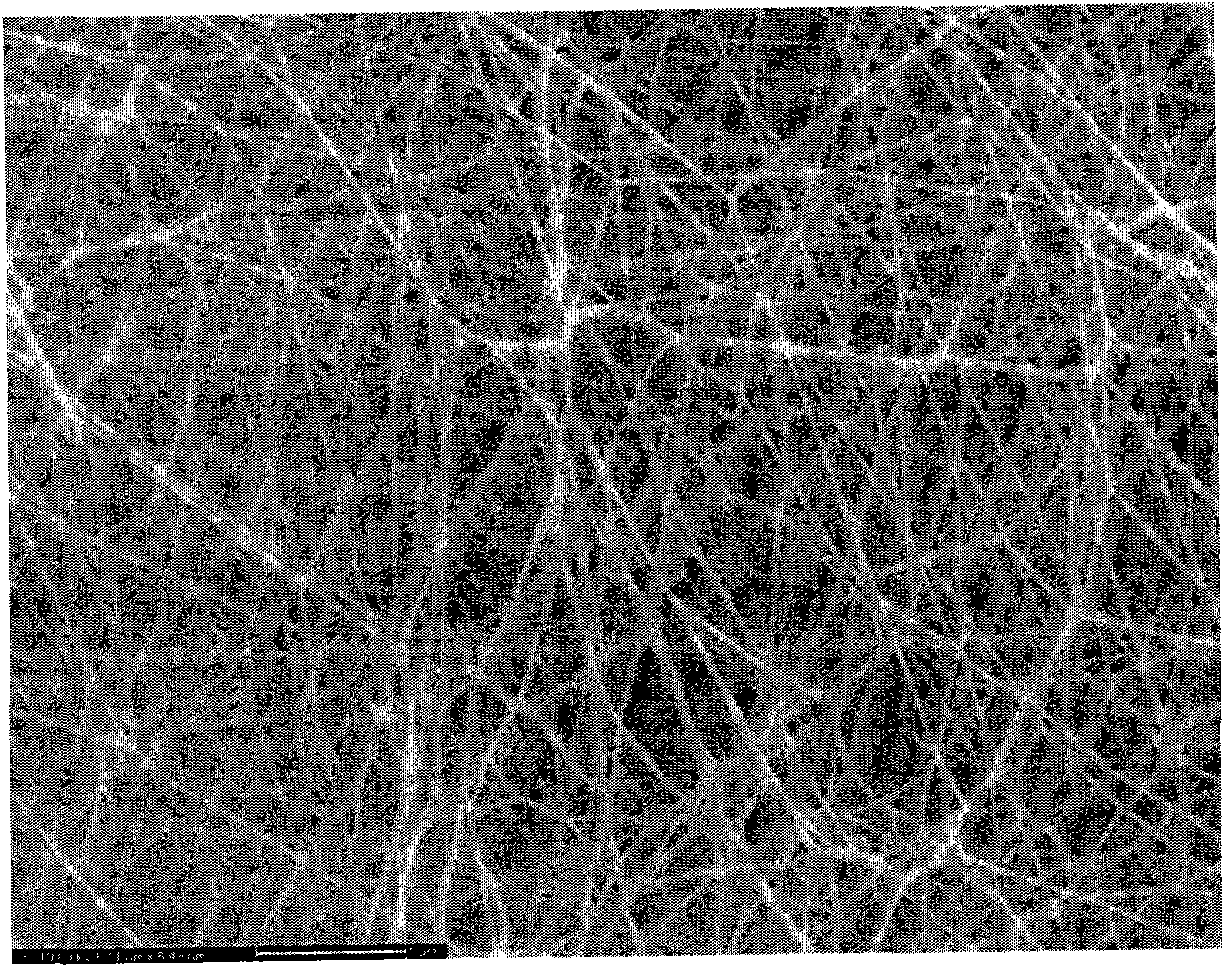 Method for preparing flamazine/bacterial cellulose composite wound dressing