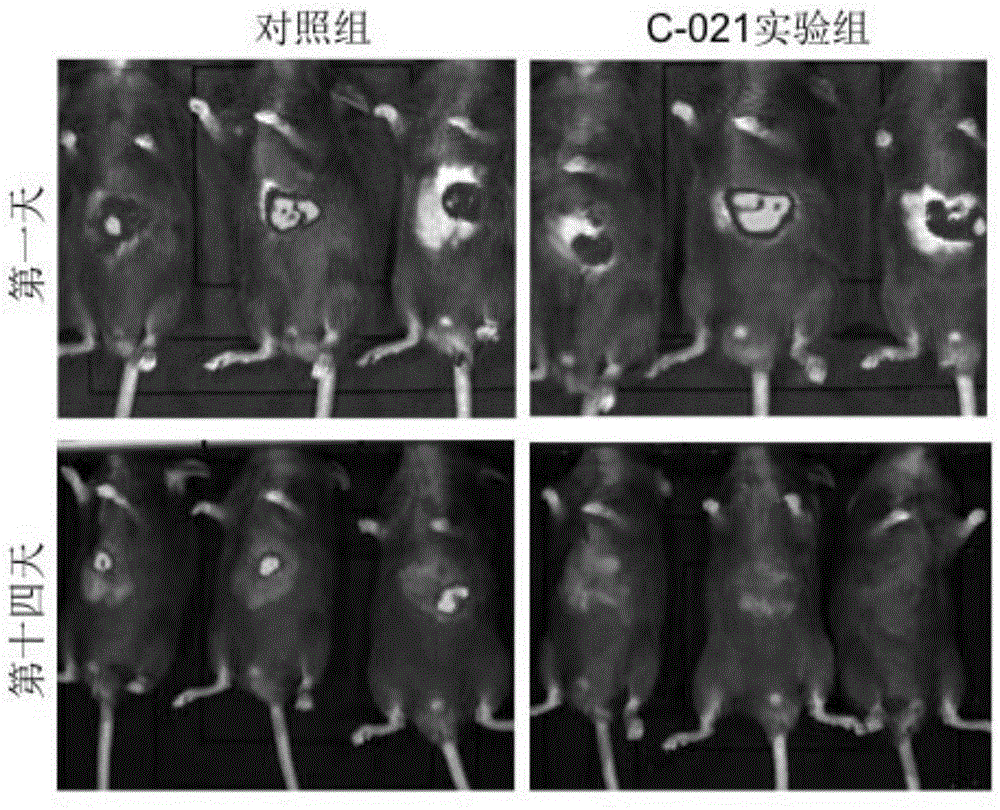 Application of CCR4 antagonist in inhibiting cancer growth and metastasis