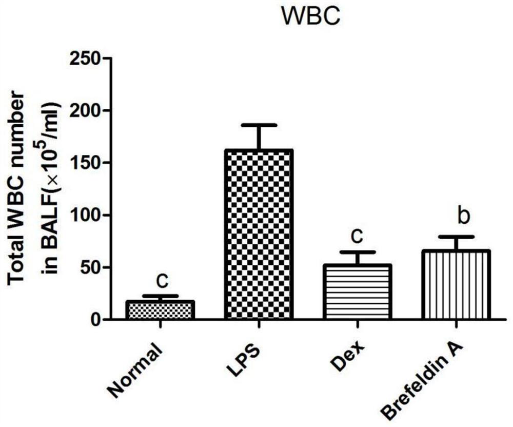 Application of a kind of brefeldin a in the preparation of inflammatory factor activity inhibitor medicine