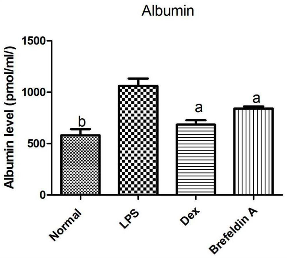 Application of a kind of brefeldin a in the preparation of inflammatory factor activity inhibitor medicine