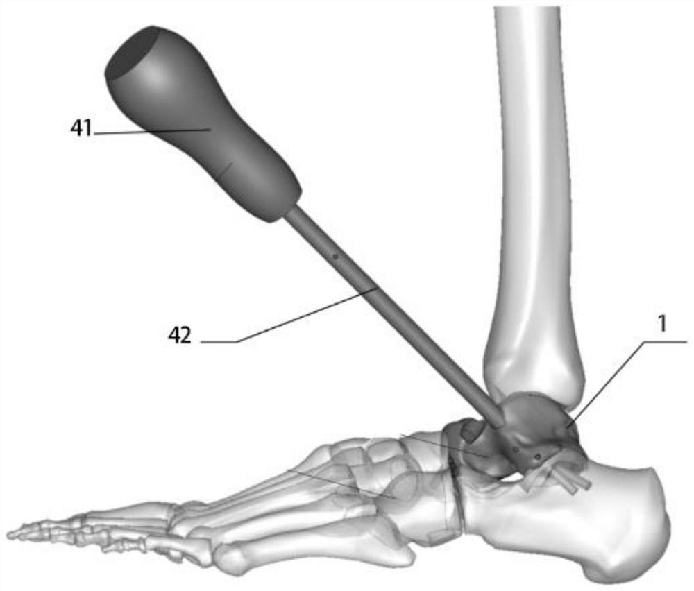 Full talus prosthesis with porous core and preparation method