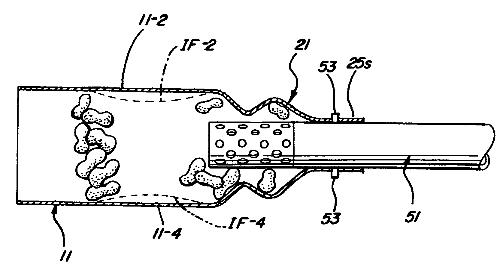 Apparatus for collecting lightweight packing particulates