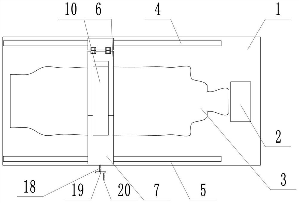 Novel abdominal radiotherapy fixing frame special for radiotherapy department