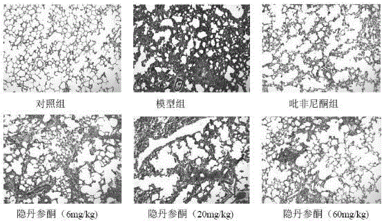 Cryptotanshinone for preventing and treating pulmonary fibrosis and application thereof