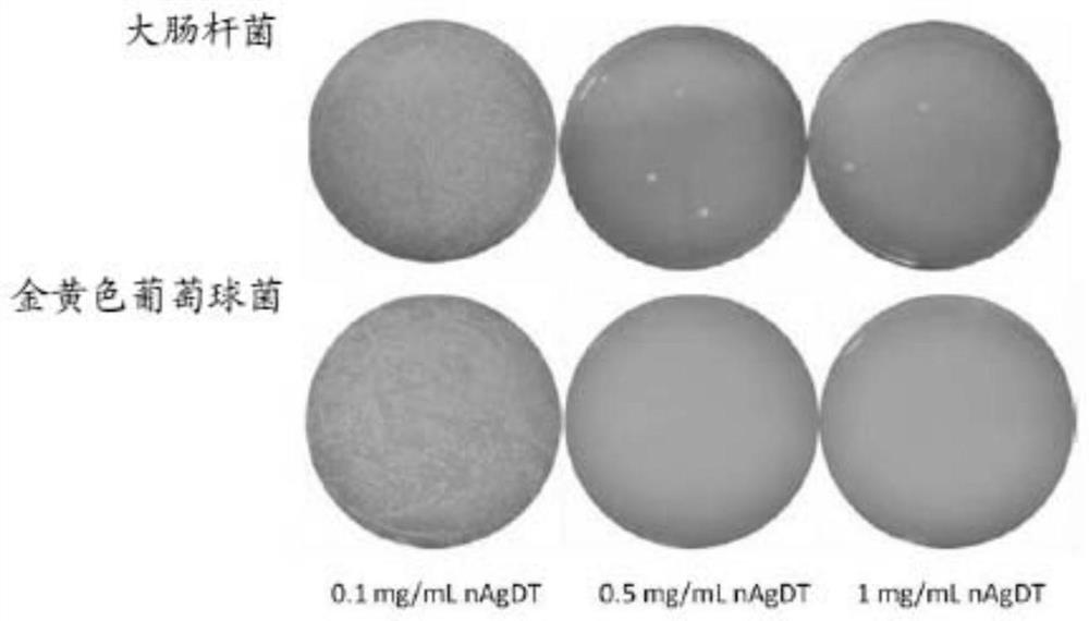 Bone cement, its preparation method and use