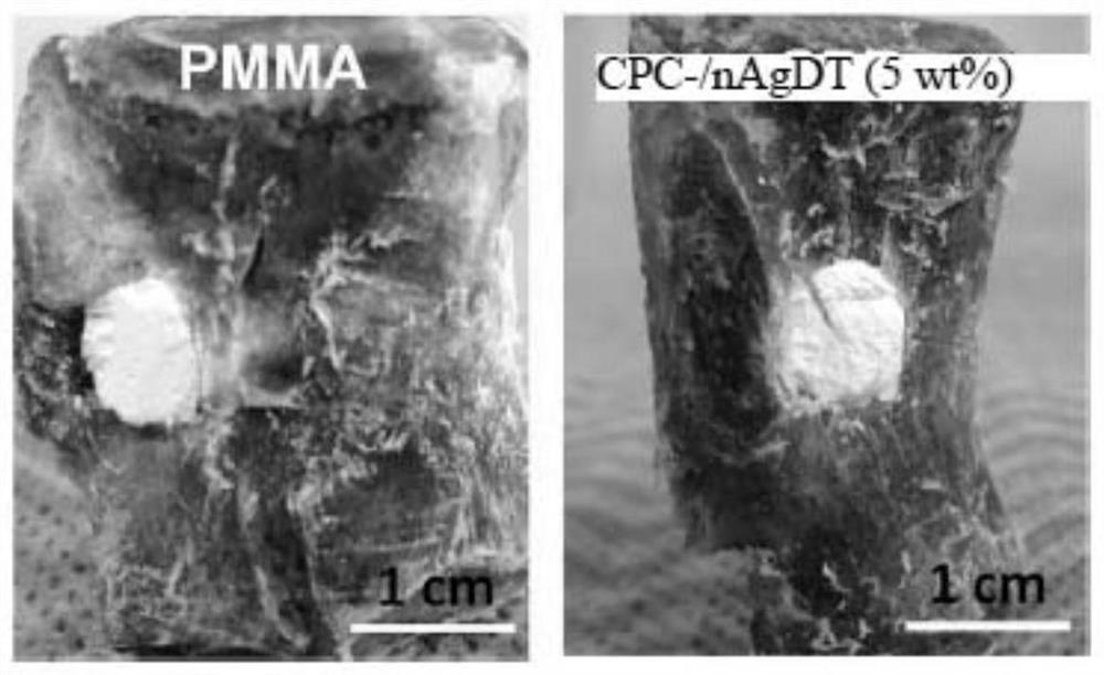 Bone cement, its preparation method and use