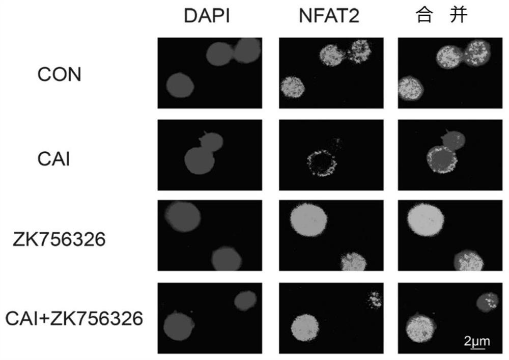 Combination of carboxyamidotriazole and ido1 inhibitor for anti-tumor purposes