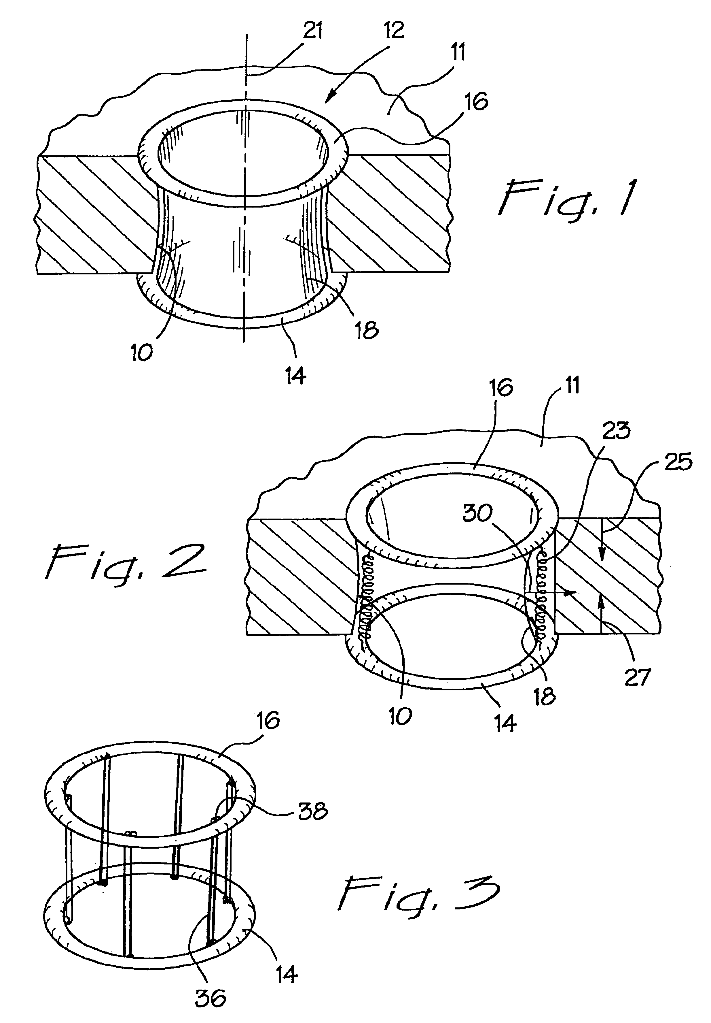 Wound retraction apparatus and method