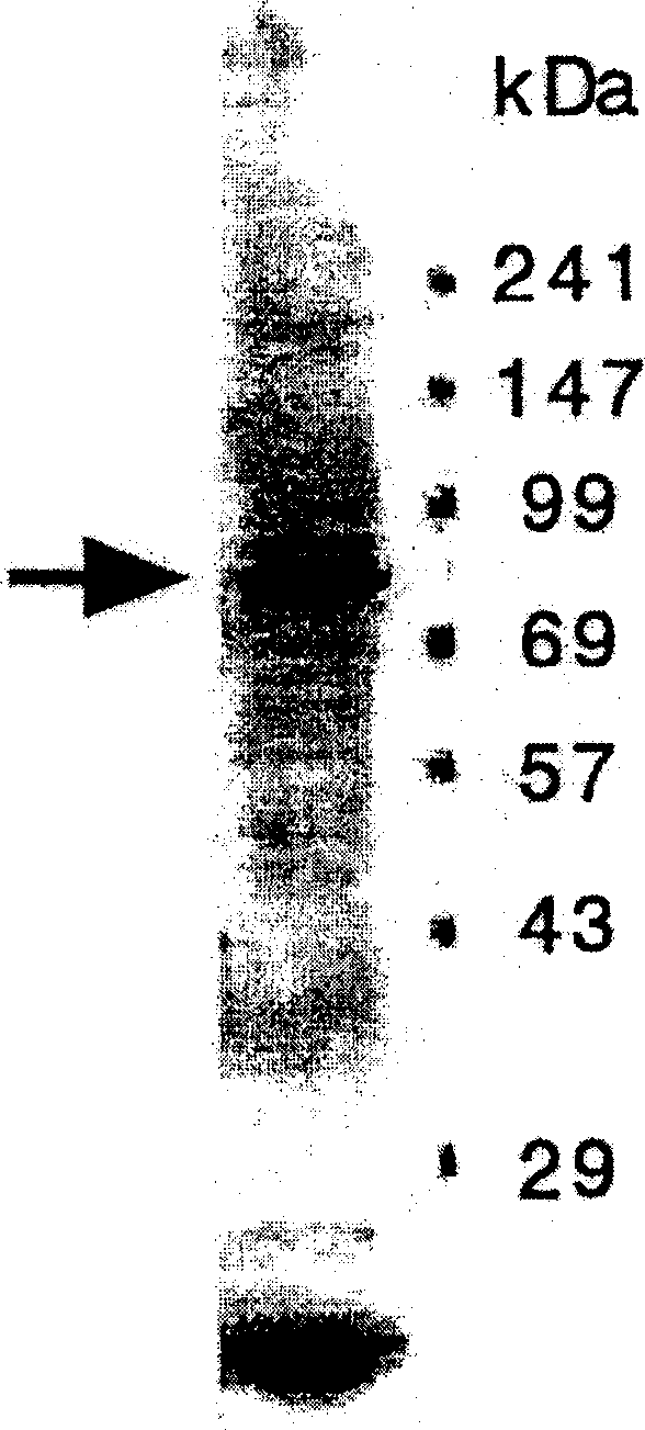 Synovial membrane cell protein