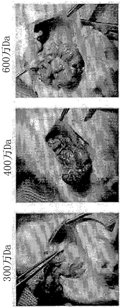 Preparation method for hyaluronic acid, and anti-adhesive composition comprising hyaluronic acid prepared by same preparation method