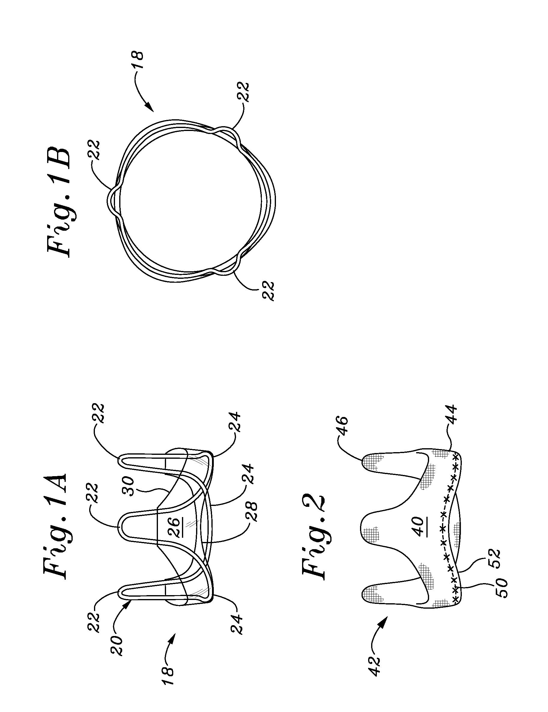 Methods for assembling components of a fabric-covered prosthetic heart valve