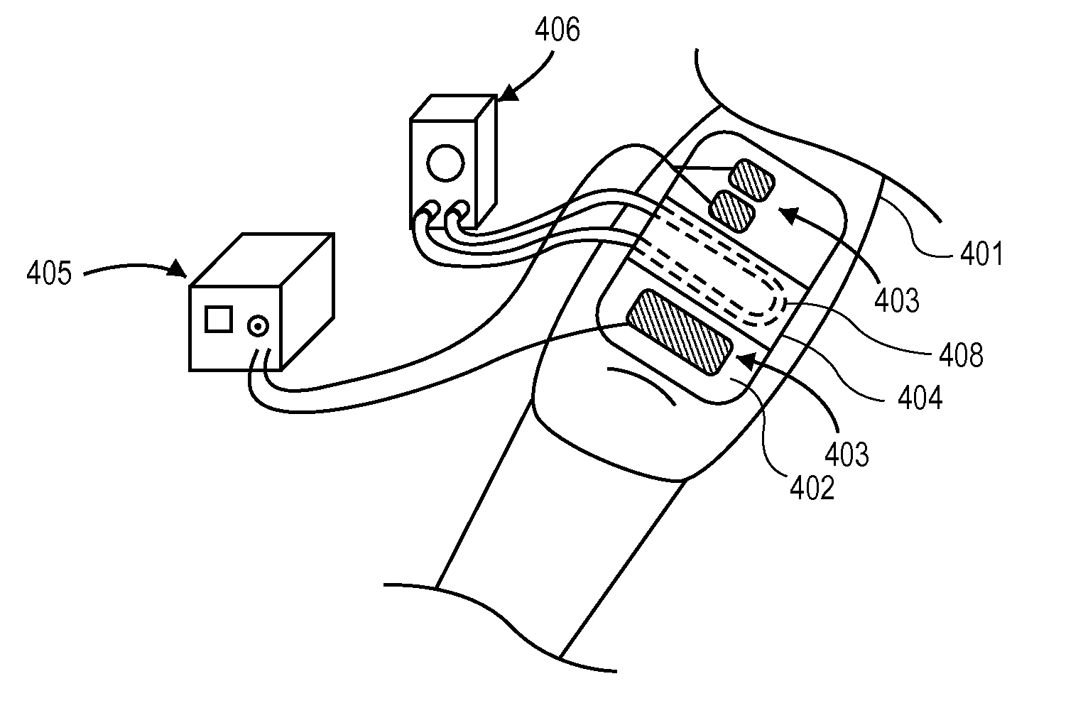 Systems and Methods of Powered Muscle Stimulation Using an Energy Guidance Field