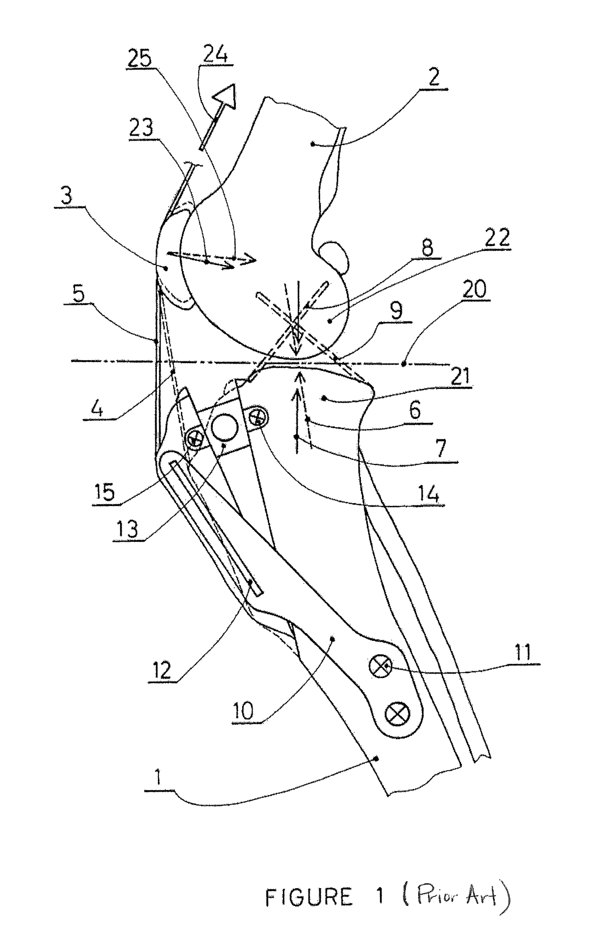 Tibial tuberosity advancement cage for ACL injuries