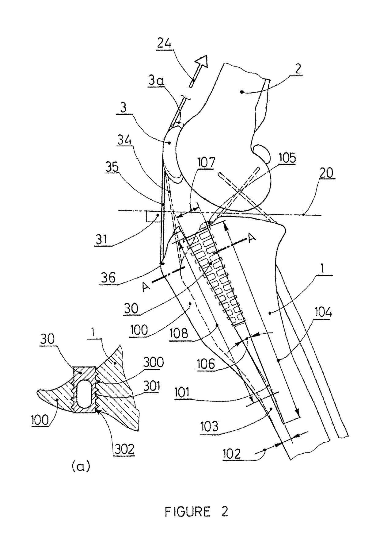 Tibial tuberosity advancement cage for ACL injuries