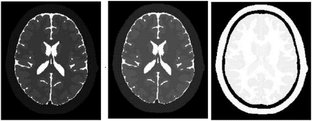 Digital MRI atlas construction method and device