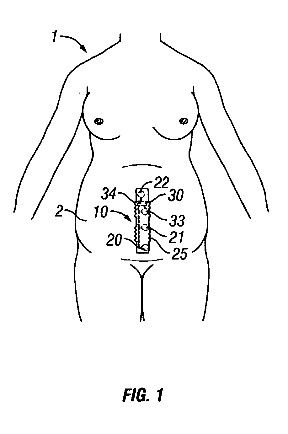 Disposable labor detection patch