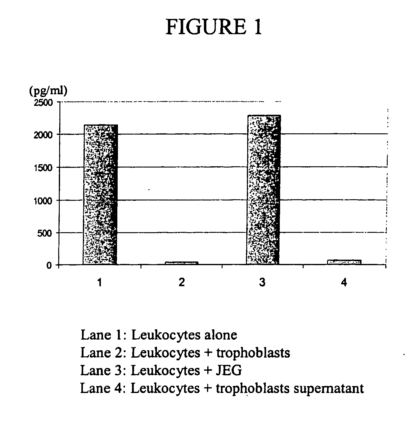 Use of soluble CD26 as inhibitor of angiogenesis and inflammation