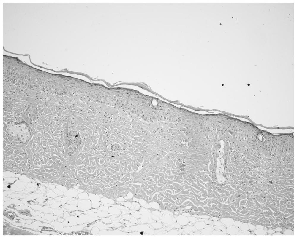 Anti-inflammatory composition, preparation method and application