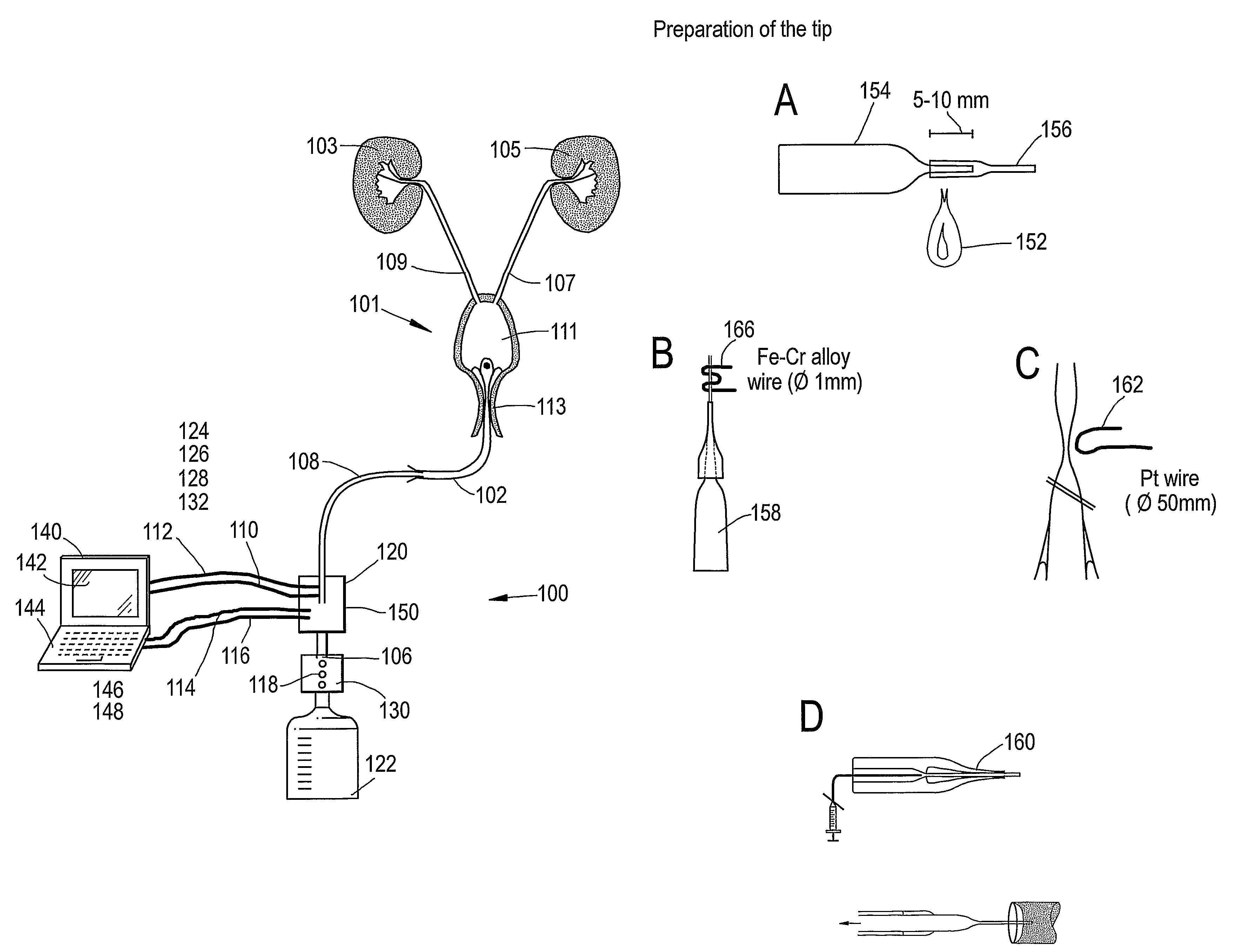 Diagnostic methods and systems based on urine analysis