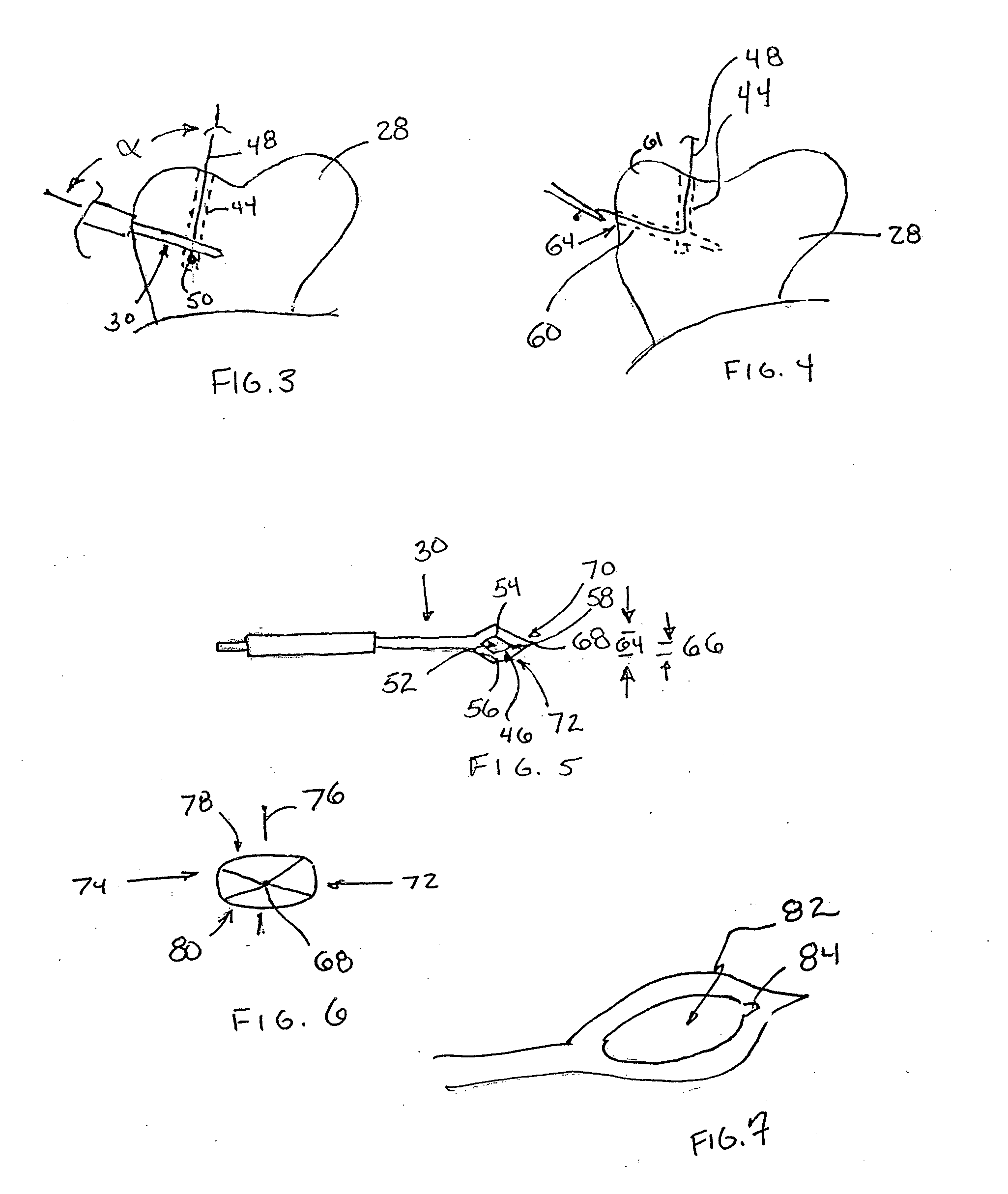 Surgical Drill Guide With Awl and Method of Use