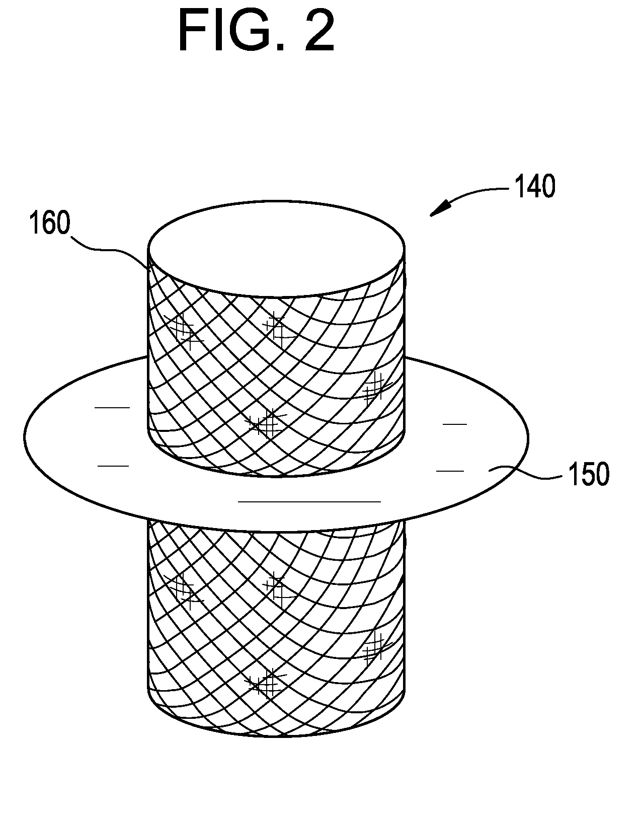 Tethers for Prosthetic Mitral Valve