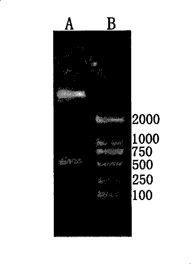 Paragonimiasis detection reagent kit and method for making same