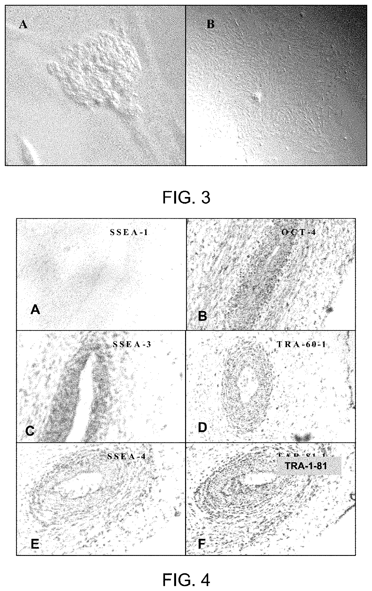 Use of cells derived from first trimester umbilical cord tissue