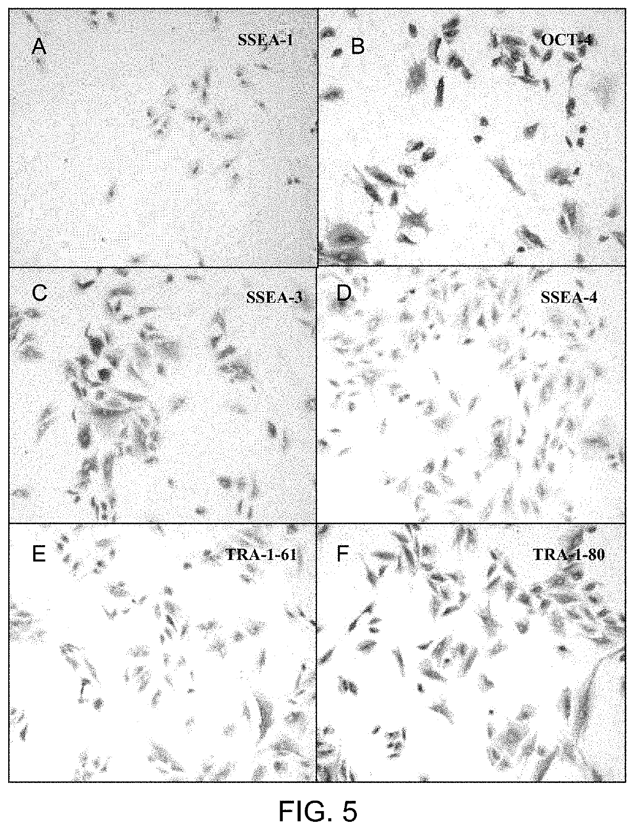 Use of cells derived from first trimester umbilical cord tissue