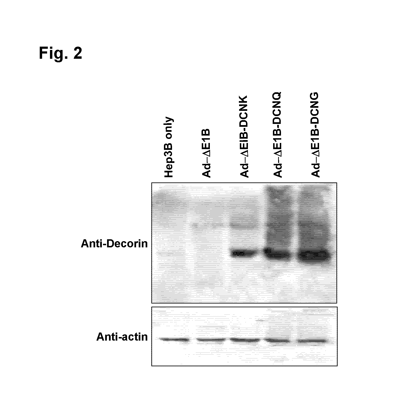 Decorin Gene Delivery System And Cancer Treatment